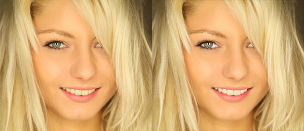 Image Trends PearlyWhites example