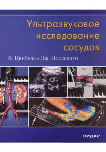 В. Цвибель, Дж. Пеллерито. Ультразвуковое исследование сосудов